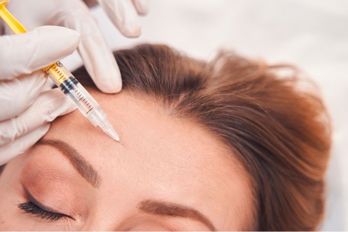 Injection d'acide hyaluronique sur le front d'une femme avec signes de vieillissement de la peau